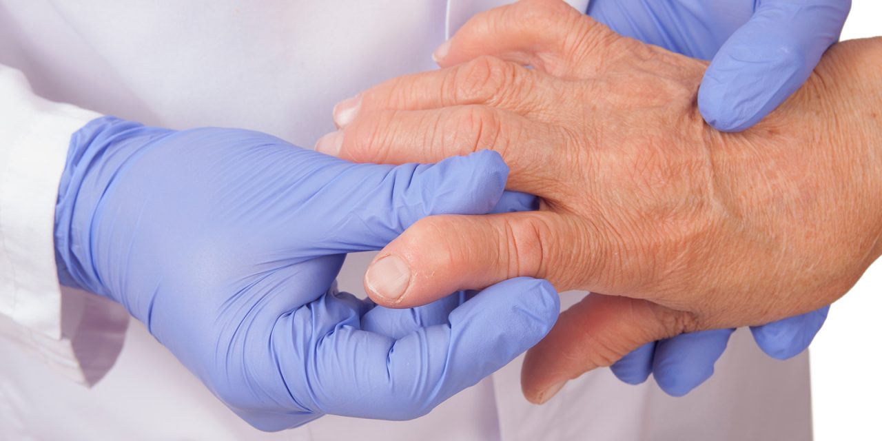 Lawan Rematik Tanpa Ketergantungan Obat, Emang Bisa?