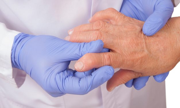 Lawan Rematik Tanpa Ketergantungan Obat, Emang Bisa?